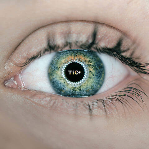 tic eye